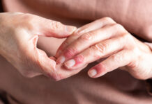 Welttag des atopischen Ekzems 2024