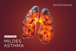 Entzündung mildes Asthma