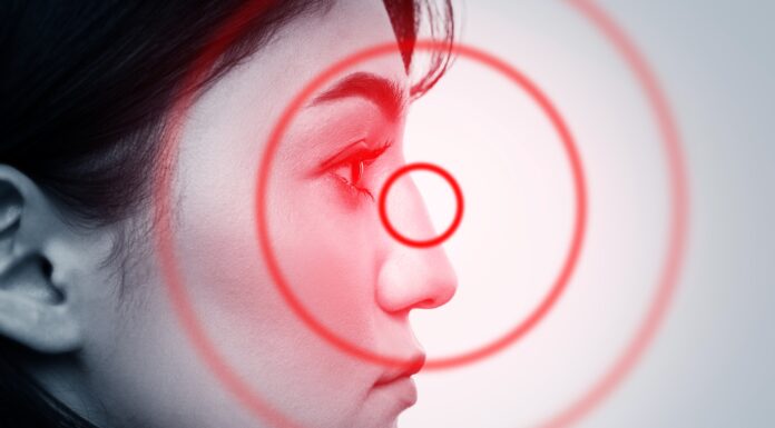 Chronische Nebenhöhlenentzündung mit Nasenpolypen – Awareness-Video